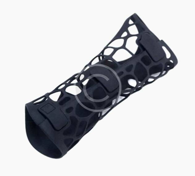 Prosthesis